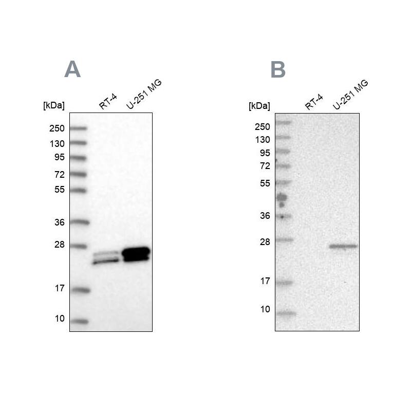 Guanylate kinase Antibody Western Blot: Guanylate kinase Antibody Antibody [NBP2-14078]