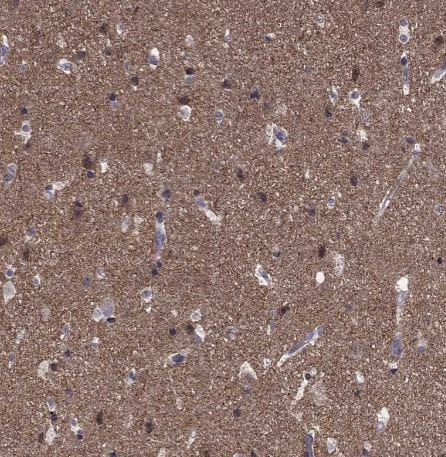 HCN1 Antibody HCN1 Antibody