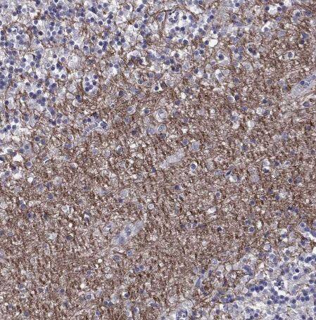 HCN1 Antibody HCN1 Antibody