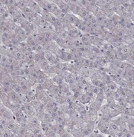 HCN1 Antibody HCN1 Antibody