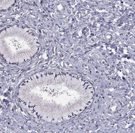 HCN1 Antibody HCN1 Antibody