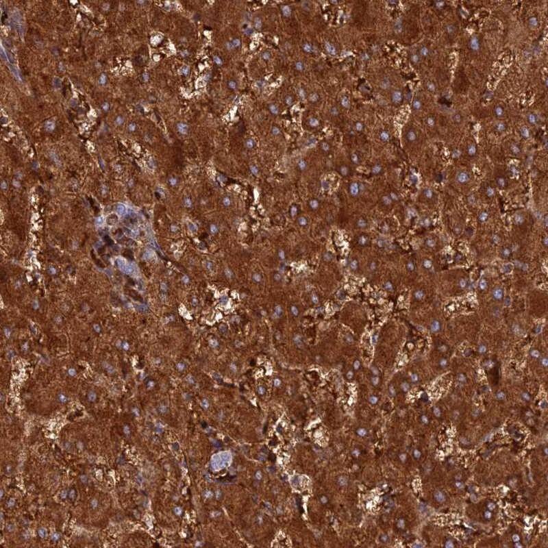 HHAT Antibody - BSA Free Immunohistochemistry-Paraffin: HHAT Antibody [NBP2-14089]