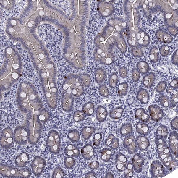 5-HT4 Antibody - BSA Free Immunohistochemistry-Paraffin: 5-HT4 Antibody [NBP2-14109]