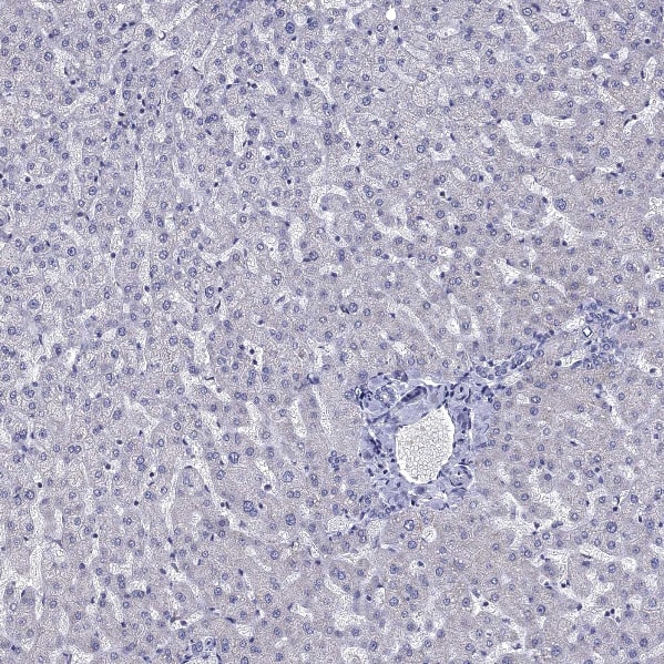 5-HT4 Antibody - BSA Free Immunohistochemistry-Paraffin: 5-HT4 Antibody [NBP2-14109]