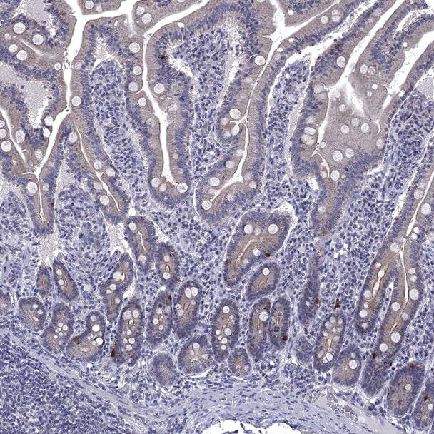 5-HT4 Antibody - BSA Free Immunohistochemistry-Paraffin: 5-HT4 Antibody [NBP2-14109]