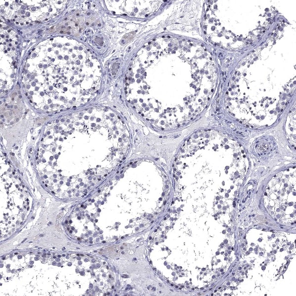 5-HT4 Antibody - BSA Free Immunohistochemistry-Paraffin: 5-HT4 Antibody [NBP2-14109]