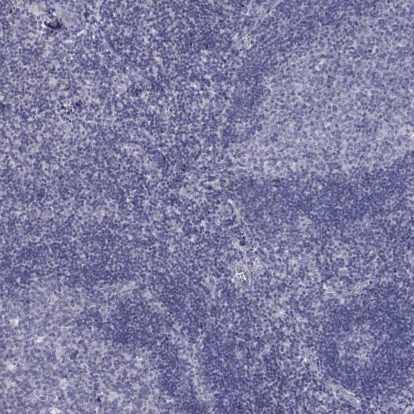 5-HT4 Antibody - BSA Free Immunohistochemistry-Paraffin: 5-HT4 Antibody [NBP2-14109]