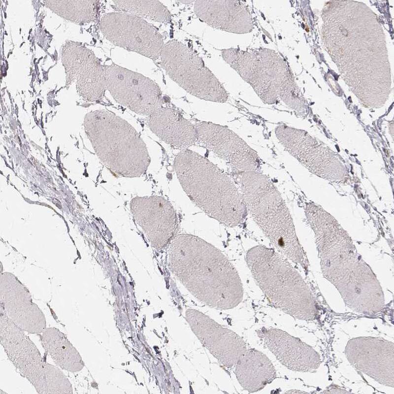 ABCA7 Antibody - BSA Free Immunohistochemistry-Paraffin: ABCA7 Antibody [NBP2-14250]