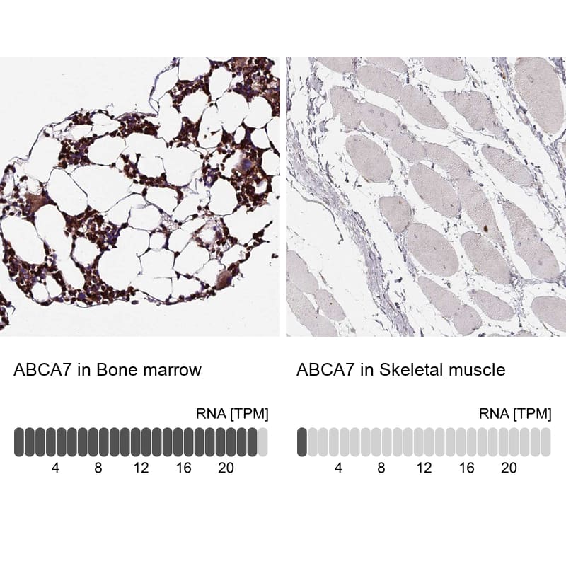 ABCA7 Antibody - BSA Free Immunohistochemistry-Paraffin: ABCA7 Antibody [NBP2-14250]