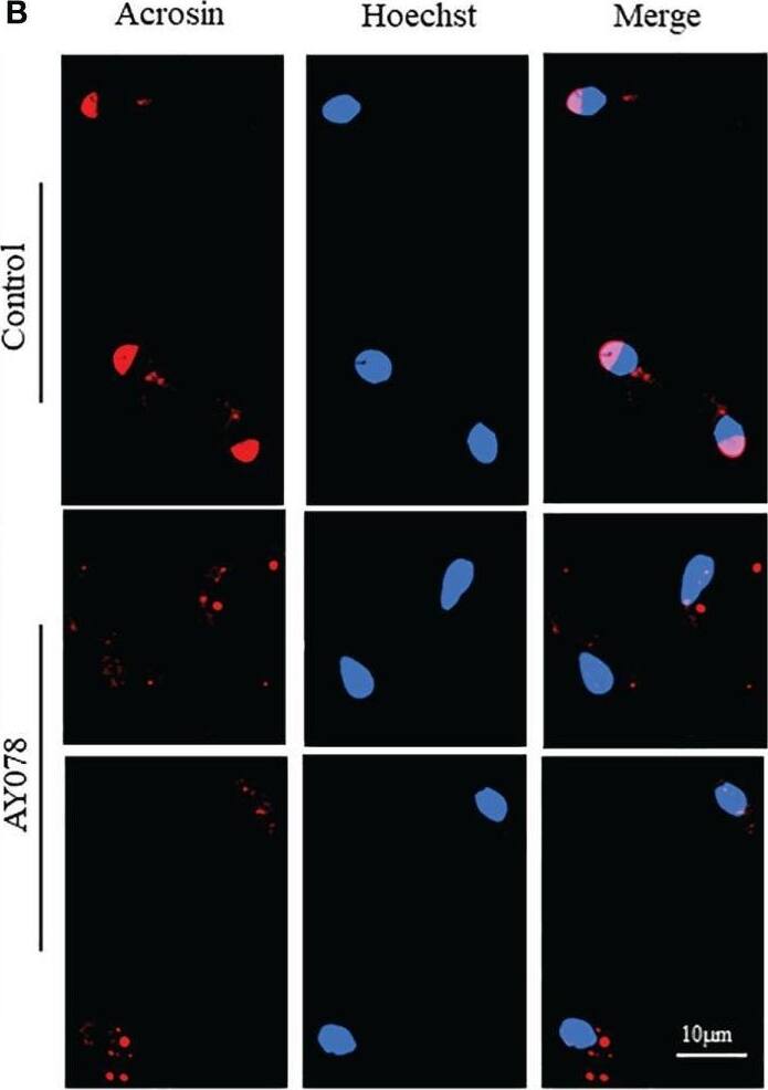 Acrosin Antibody - BSA Free