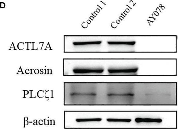 Acrosin Antibody - BSA Free