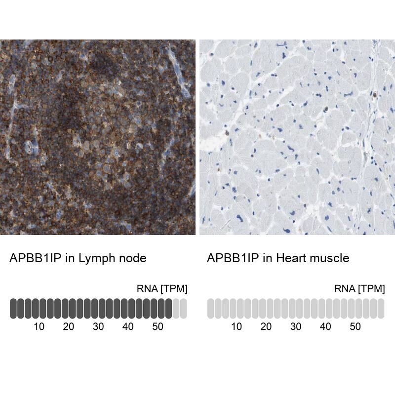 RIAM/APBB1IP Antibody - BSA Free Immunohistochemistry-Paraffin: RIAM/APBB1IP Antibody [NBP2-14300]