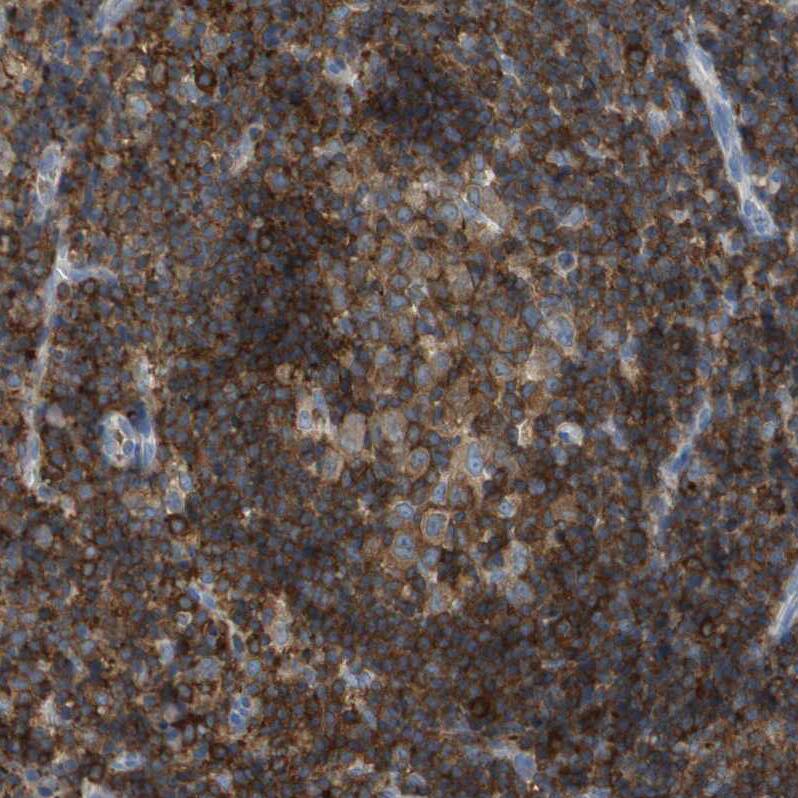 RIAM/APBB1IP Antibody - BSA Free Immunohistochemistry-Paraffin: RIAM/APBB1IP Antibody [NBP2-14300]