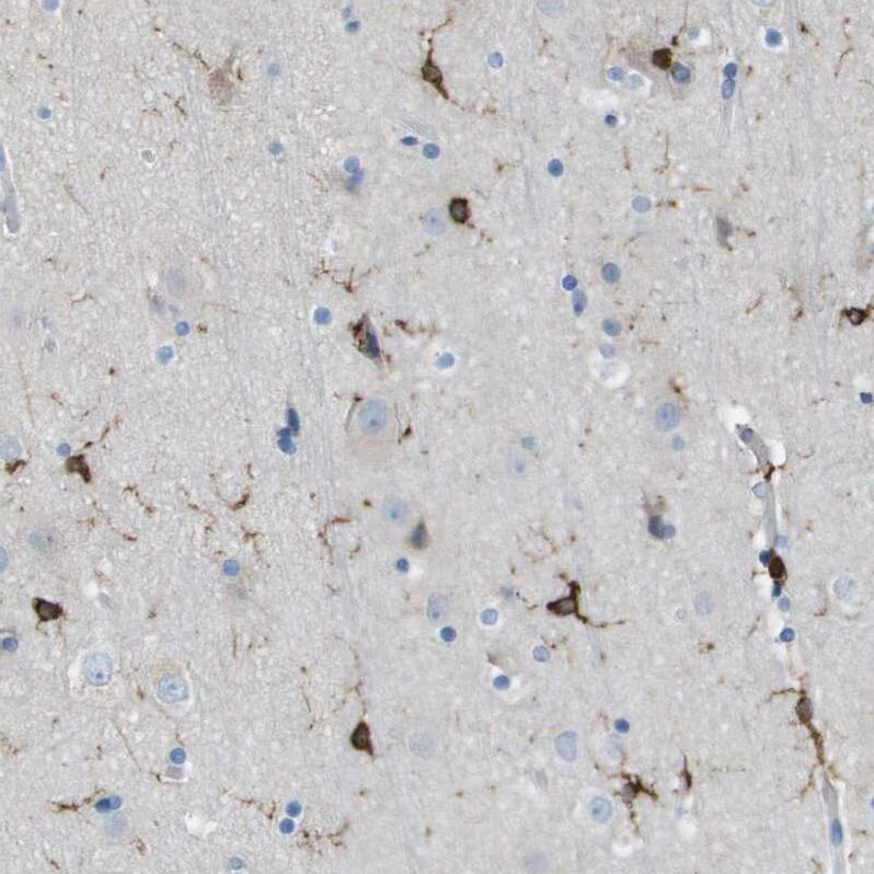RIAM/APBB1IP Antibody - BSA Free Immunohistochemistry-Paraffin: RIAM/APBB1IP Antibody [NBP2-14300]