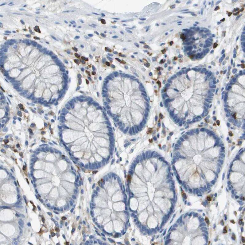 RIAM/APBB1IP Antibody - BSA Free Immunohistochemistry-Paraffin: RIAM/APBB1IP Antibody [NBP2-14300]