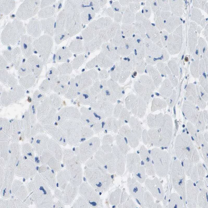 RIAM/APBB1IP Antibody - BSA Free Immunohistochemistry-Paraffin: RIAM/APBB1IP Antibody [NBP2-14300]