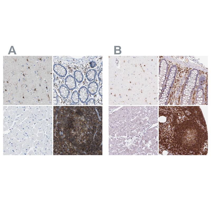 RIAM/APBB1IP Antibody - BSA Free Immunohistochemistry-Paraffin: RIAM/APBB1IP Antibody [NBP2-14300]