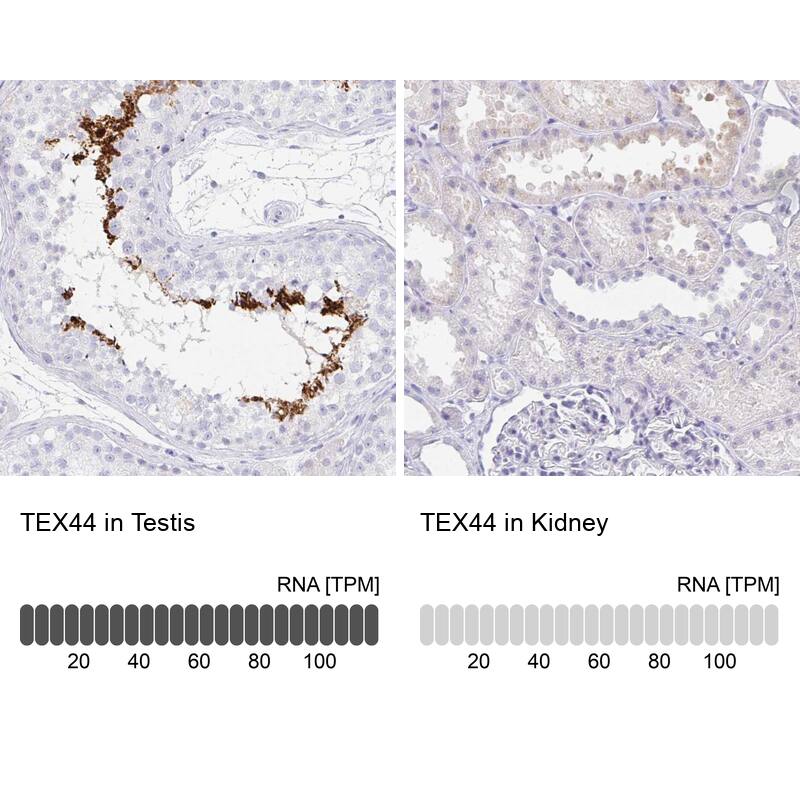 TEX44 Antibody Immunohistochemistry-Paraffin: TEX44 Antibody [NBP2-14406]