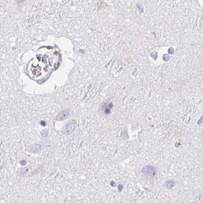 TEX44 Antibody Immunohistochemistry-Paraffin: TEX44 Antibody [NBP2-14406]