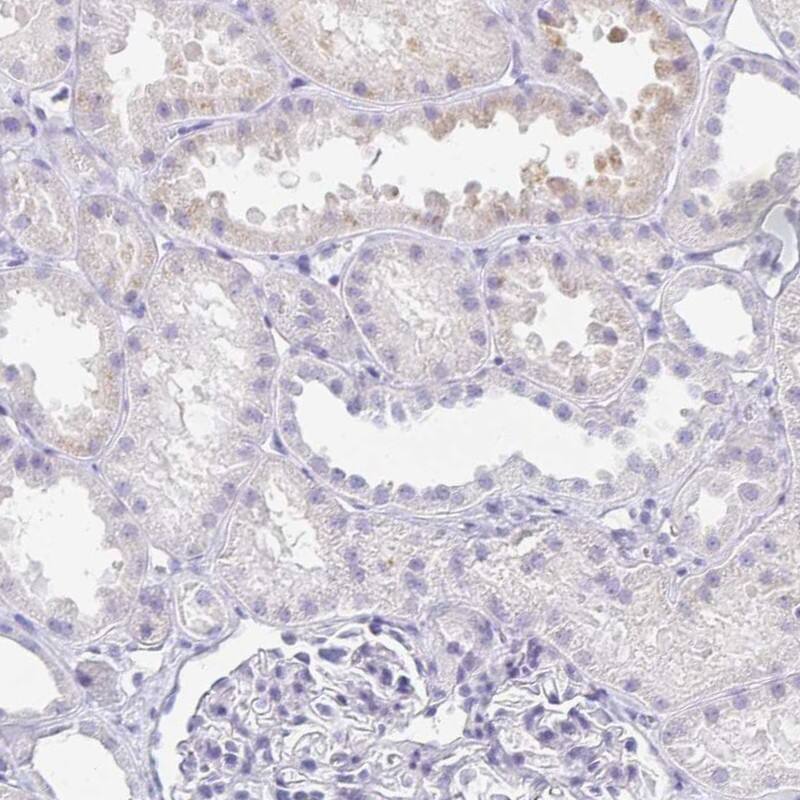 TEX44 Antibody Immunohistochemistry-Paraffin: TEX44 Antibody [NBP2-14406]