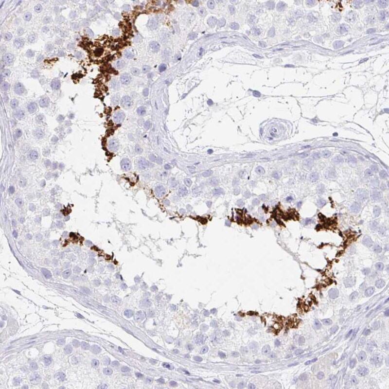 TEX44 Antibody Immunohistochemistry-Paraffin: TEX44 Antibody [NBP2-14406]