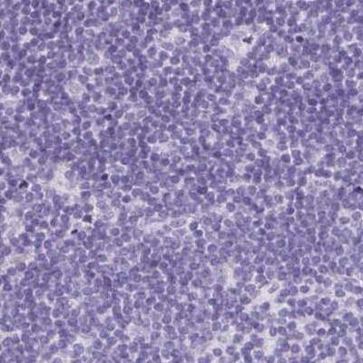 TEX44 Antibody Immunohistochemistry-Paraffin: TEX44 Antibody [NBP2-14406]