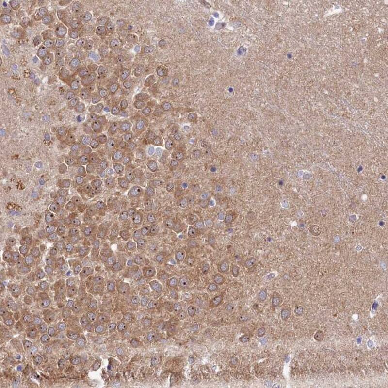 RGS7BP Antibody - BSA Free Immunohistochemistry-Paraffin: RGS7BP Antibody [NBP2-14504]