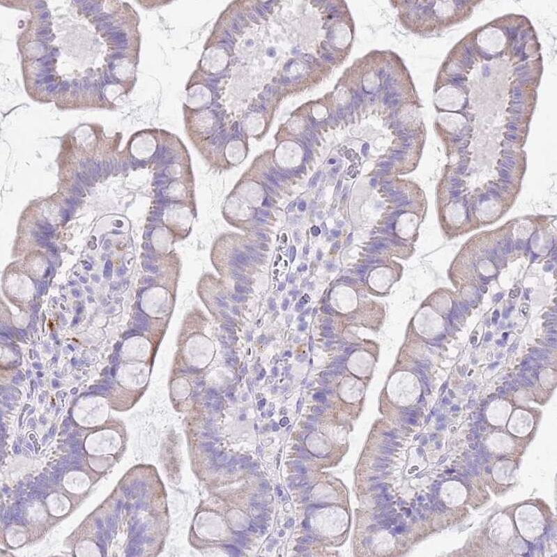 FAM108C1 Antibody Immunohistochemistry-Paraffin: FAM108C1 Antibody [NBP2-14659] -