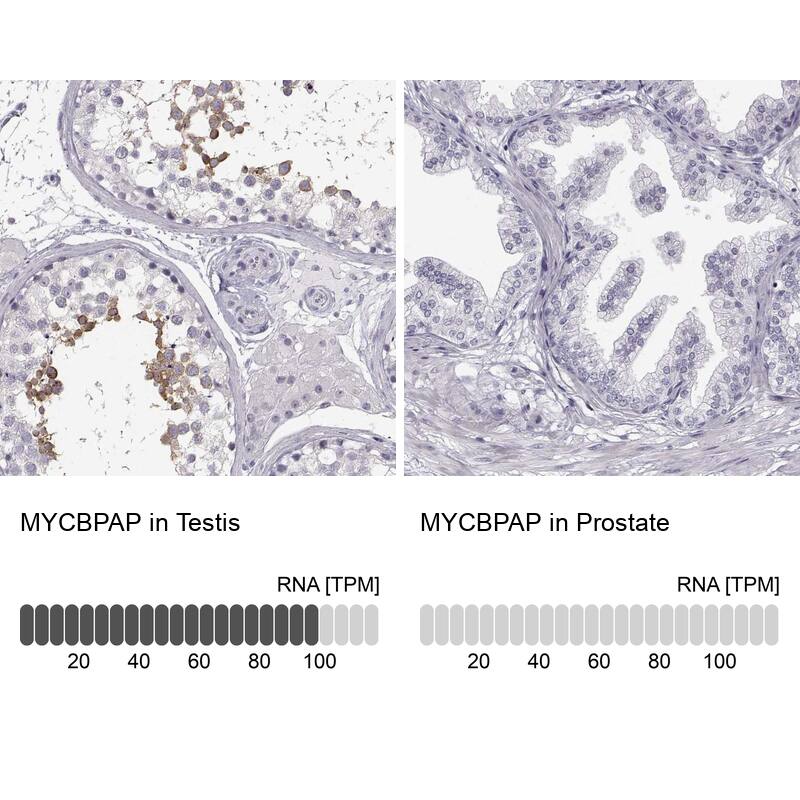 MYCBPAP Antibody - BSA Free Immunohistochemistry-Paraffin: MYCBPAP Antibody [NBP2-14790]