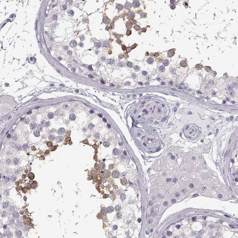 MYCBPAP Antibody - BSA Free Immunohistochemistry-Paraffin: MYCBPAP Antibody [NBP2-14790]