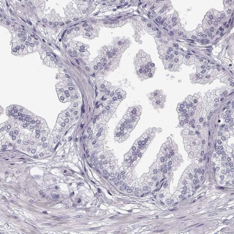 MYCBPAP Antibody - BSA Free Immunohistochemistry-Paraffin: MYCBPAP Antibody [NBP2-14790]
