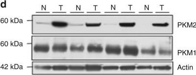 PKM1 Antibody - BSA Free