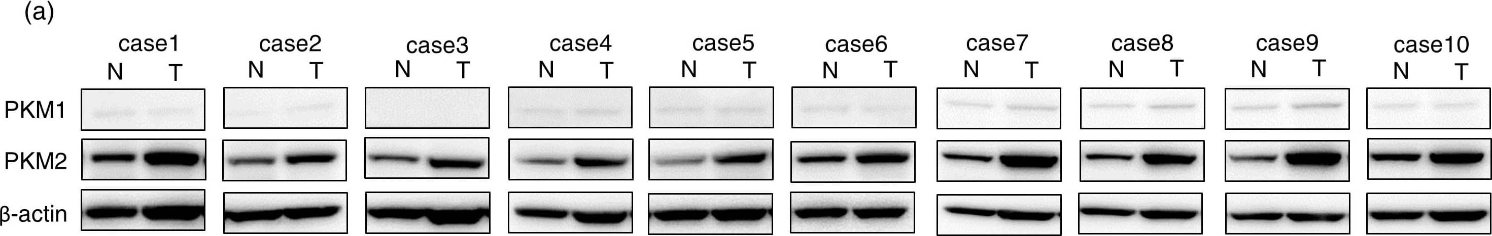 PKM1 Antibody - BSA Free