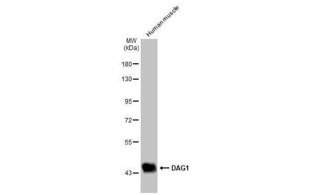 Dystroglycan Antibody