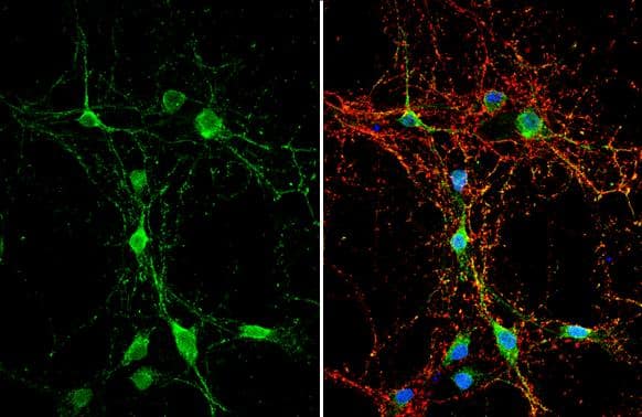 Dystroglycan Antibody - BSA Free