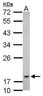 CSRP1 Antibody