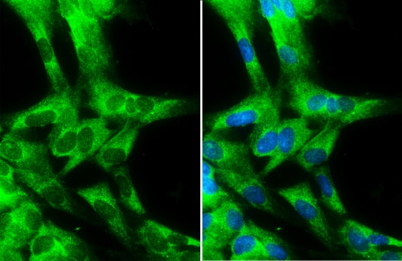 Cytochrome b5 type A Antibody