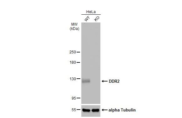 DDR2 Antibody