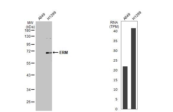 ETV5/ERM Antibody - BSA Free
