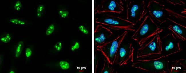 Exosome component 5 Antibody