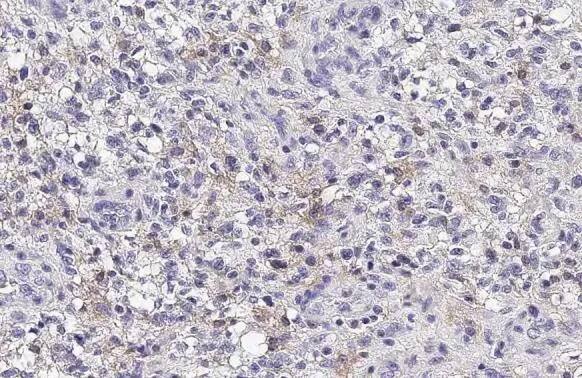 VILIP3 Antibody