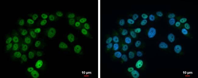 Islet-1 Antibody - BSA Free