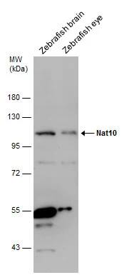 NAT10 Antibody