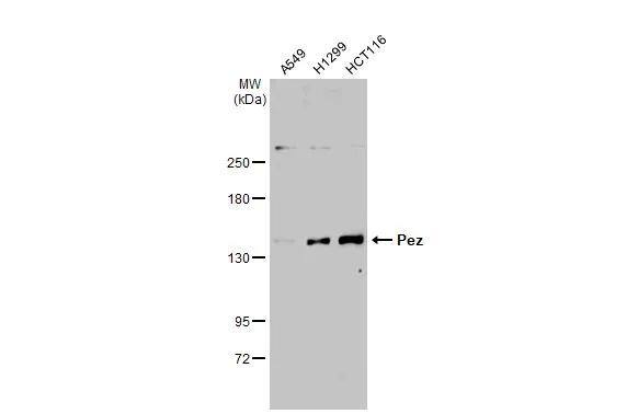 PTPN14/PTPD2 Antibody - BSA Free