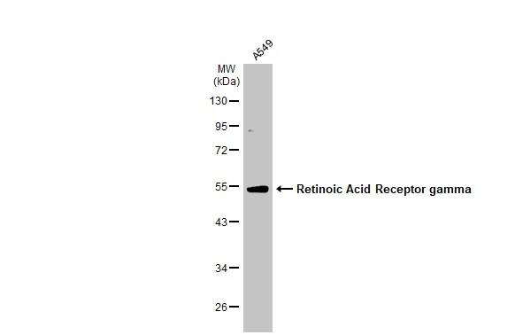 RAR gamma/NR1B3 Antibody