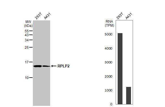 RPLP2 Antibody