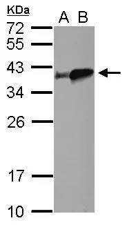 tropomyosin-4 Antibody
