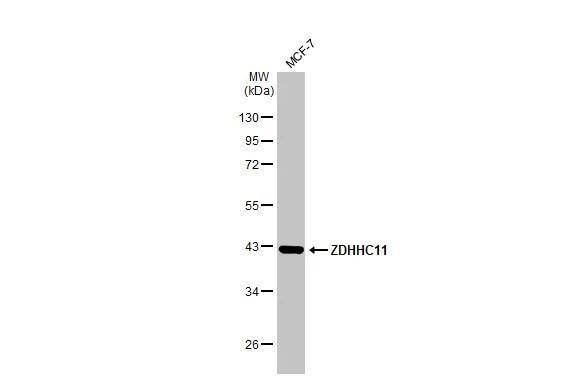 ZDHHC11 Antibody - BSA Free