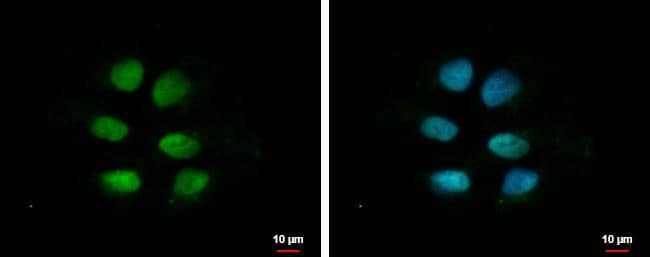 ZNF571 Antibody - BSA Free