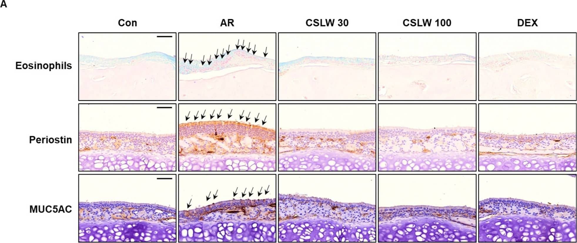 MUC5AC Antibody (45M1)
